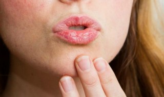 Πώς να αποφύγετε τα σκασμένα χείλη Λεία και βελούδινα